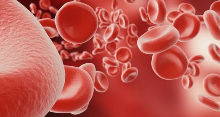 Hemoglobin Test and Anemia