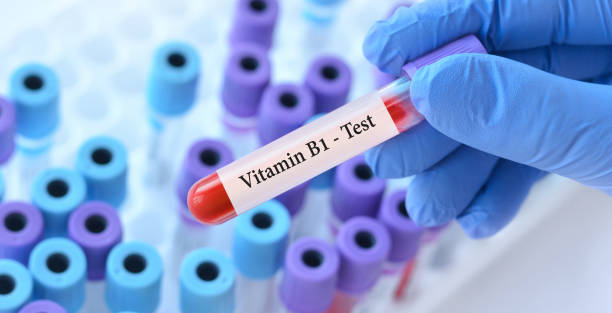 Comprehensive Guide to Vitamin B1 Test in Pune: Benefits, Procedure, and Where to Get Tested