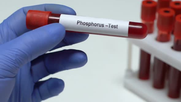 Phosphorus Test | Importance, Procedure & Results Explained